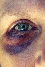 blue eye.png